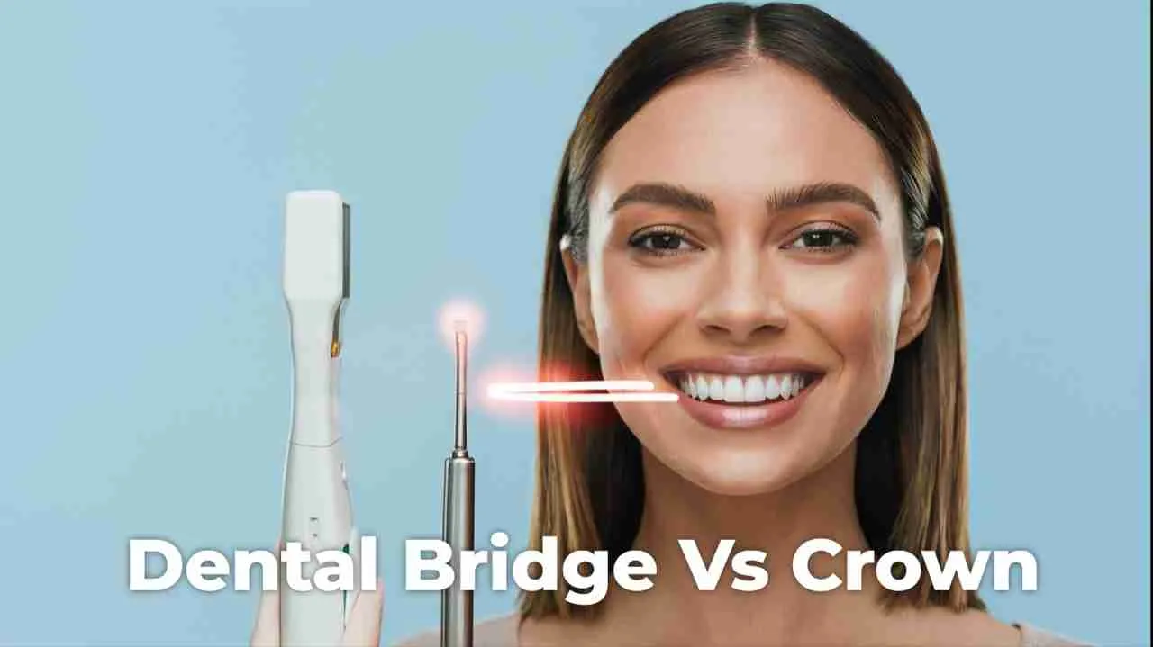 Dental Bridge vs Crown: Which is Best? Dent Blanche Dental