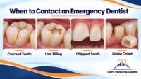 Examples of dental emergencies including a cracked tooth, lost filling, chipped tooth, and loose crown. This requires a visit to your emergency dentist at Dent blanche Dental