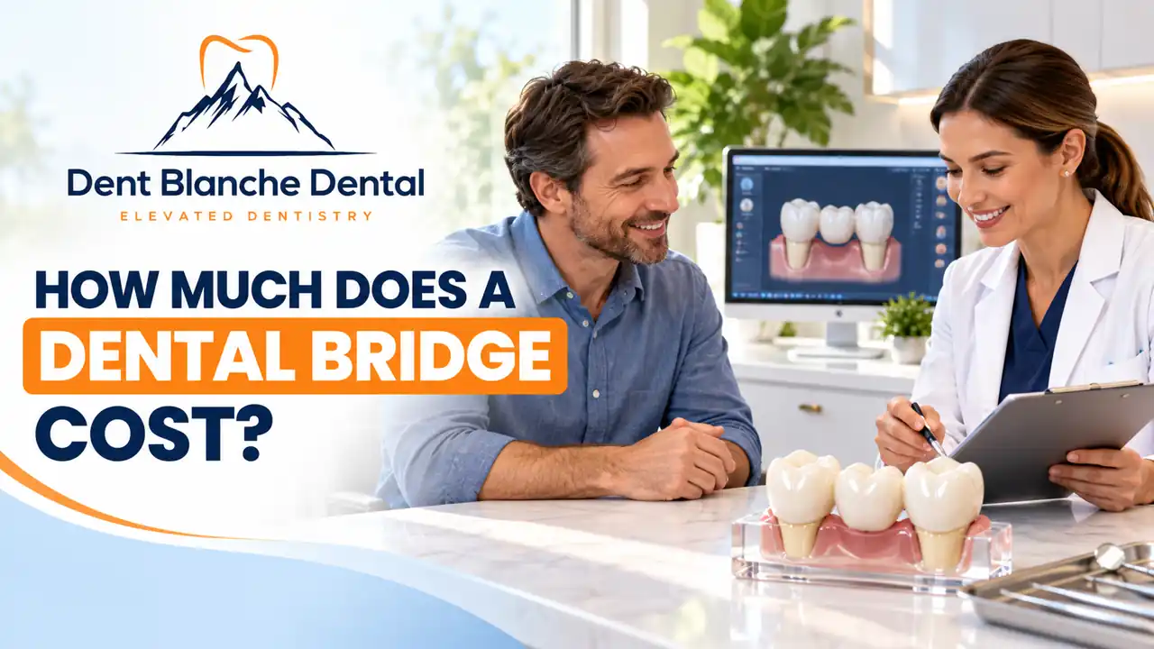 How Much Does a Dental Bridge Cost? Best Expert Guide How Much Does a Dental Bridge Cost? Best Expert Guide